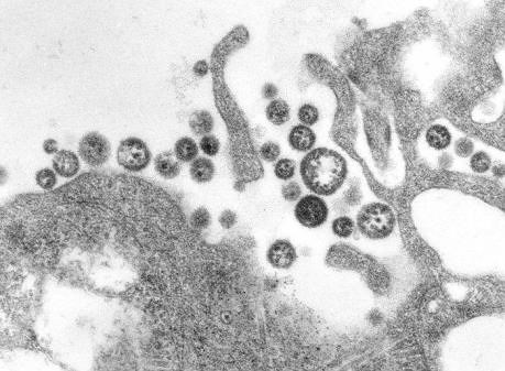 WEF cảnh báo mầm bệnh lây nhiễm có thể lan khắp châu lục trong vòng 36 giờ