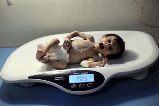Bức ảnh em bé chết đói hé lộ tình trạng khủng hoảng lương thực ở Syria