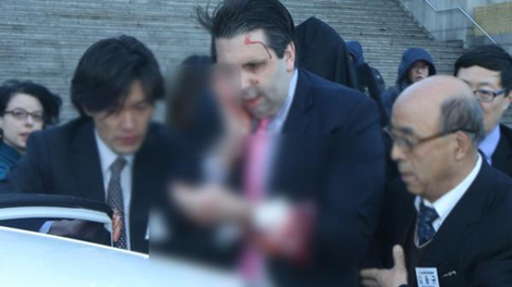 Cận cảnh vụ Đại sứ Mỹ tại Hàn Quốc bị tấn công