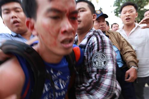 Lại tranh chấp đổ máu tại chung cư ở Sài Gòn