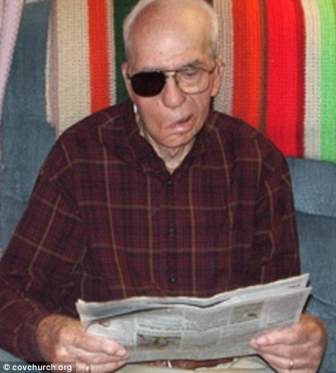 Bị đạn găm trong đầu vẫn sống thêm gần 100 tuổi