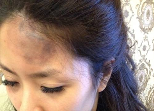 Người mẫu Hồng Quế bị tố đánh người