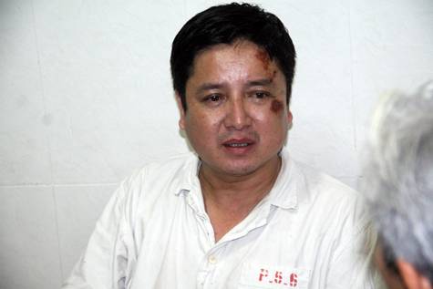 Chí Trung lỡ show vì tai nạn gãy xương sườn