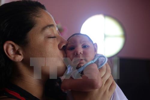 Mỹ xác định thai nhi đầu tiên bị dị tật đầu nhỏ do virus Zika