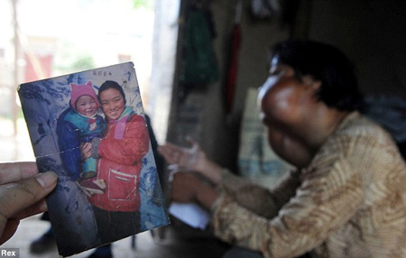 Người phụ nữ có khuôn mặt... quái vật