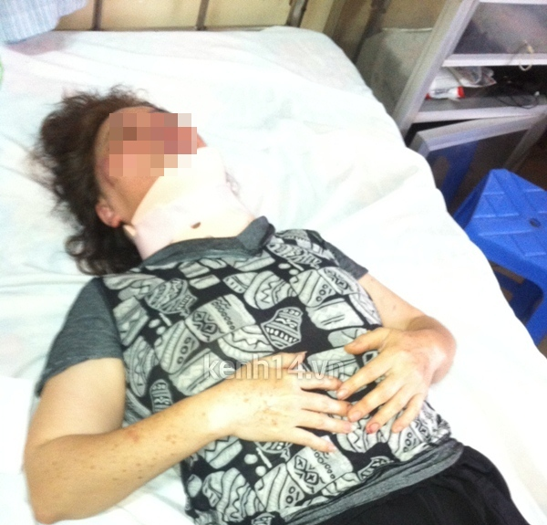 Hà Nội: Đau lòng con trai giữ mẹ cho bố đánh đến gãy cổ