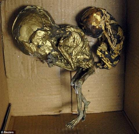 Rùng rợn thai nhi bị sấy khô, dát vàng