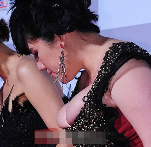 Nhức mắt vì vòng 1 