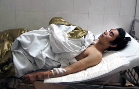 Vụ sập giàn giáo cao ốc qua lời kể của nạn nhân