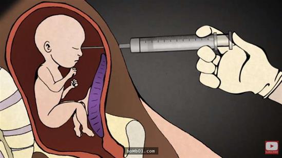 Bác sĩ từ chức sau ''1200 lần phá thai'', khi nghe ông mô tả thì thật đáng sợ…