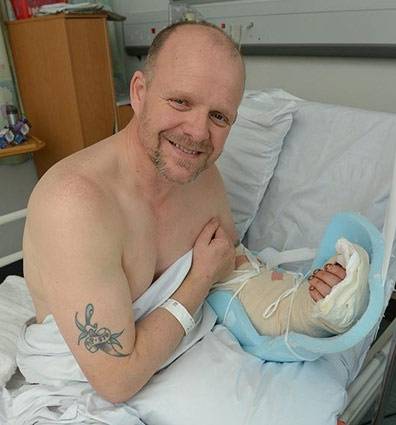 Anh: Tự ôm cánh tay đứt lìa đi cấp cứu