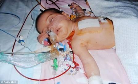 Vừa phẫu thuật tim, bé 2 tuổi bơi như... cá