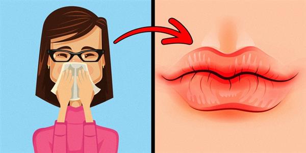 8 dấu hiệu của đôi môi tiết lộ tình trạng sức khoẻ của bạn