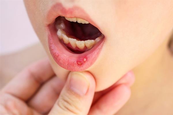 Một số vấn đề sức khỏe răng miệng không phải ai cũng biết