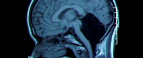 Những khả năng phi thường của con người khiến giới khoa học phải ngỡ ngàng