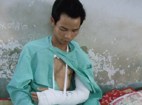 TP.HCM: Chặt lìa tay, cướp Iphone TQ ngay trước nhà