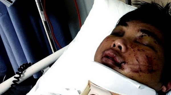 Cảnh sát Úc xin bỏ lệnh cấm sinh viên Dương Minh Tuấn