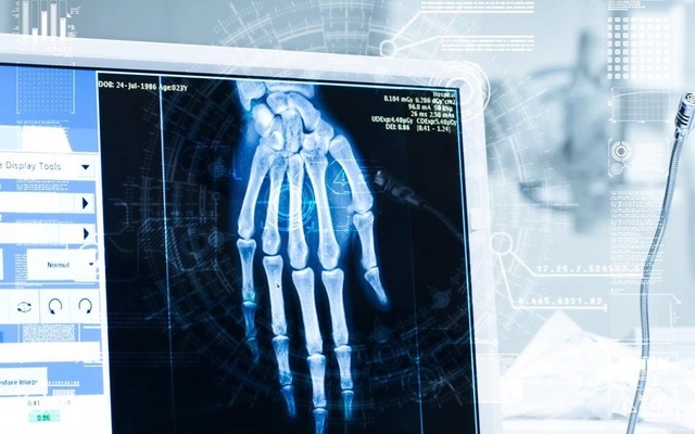 Nga ứng dụng AI trong chẩn đoán X-quang