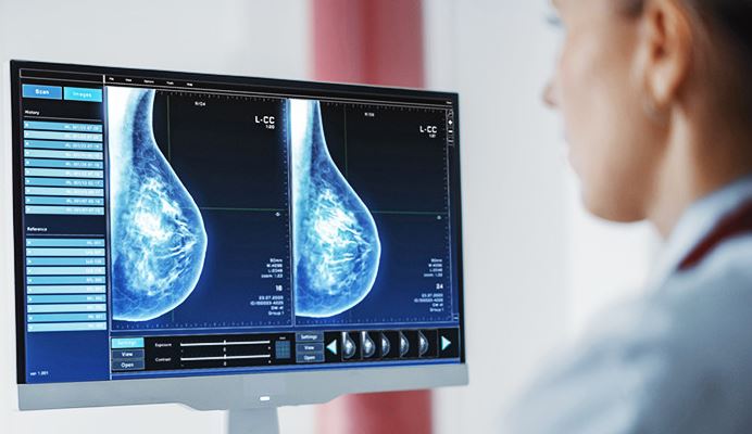 Trí tuệ nhân tạo: Hệ thống AI hỗ trợ phát hiện sớm ung thư vú