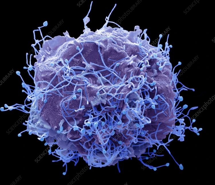 Nga xác định nhóm nguy cơ nhiễm virus HMPV gây bệnh đường hô hấp