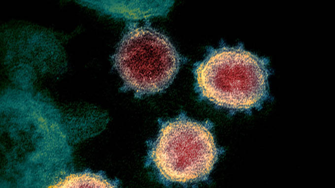 Ca mắc hiếm gặp khi nhiễm cùng lúc 2 biến thể của virus SARS-CoV-2