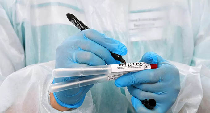 Nga đăng ký bộ test nhanh chẩn đoán coronavirus