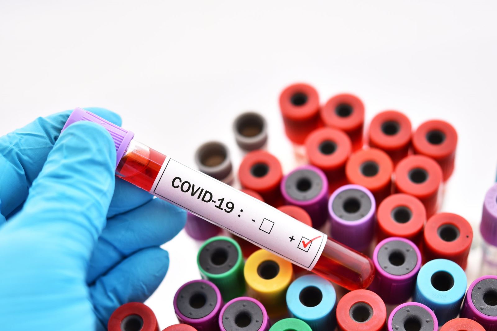 Mỹ xác nhận ca COVID-19 đầu tiên không liên quan đến những người nhiễm bệnh trước
