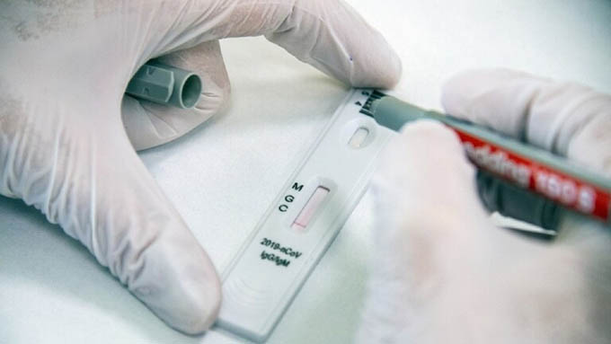 Nga phát triển dụng cụ đo kháng thể đối với coronavirus tại nhà