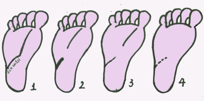 Khám phá hôn nhân qua lòng bàn chân