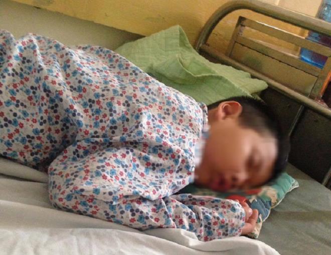 Học sinh lớp 1 bị bố của bạn hành hung: Hội Bảo vệ quyền trẻ em Việt Nam lên tiếng