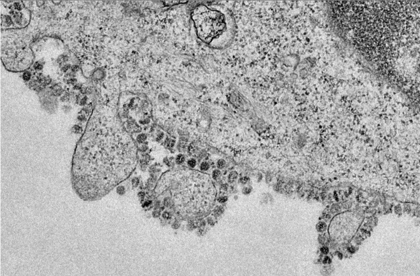 Virus Corona có thể tạo ra hàng ngàn hạt mang virus mới