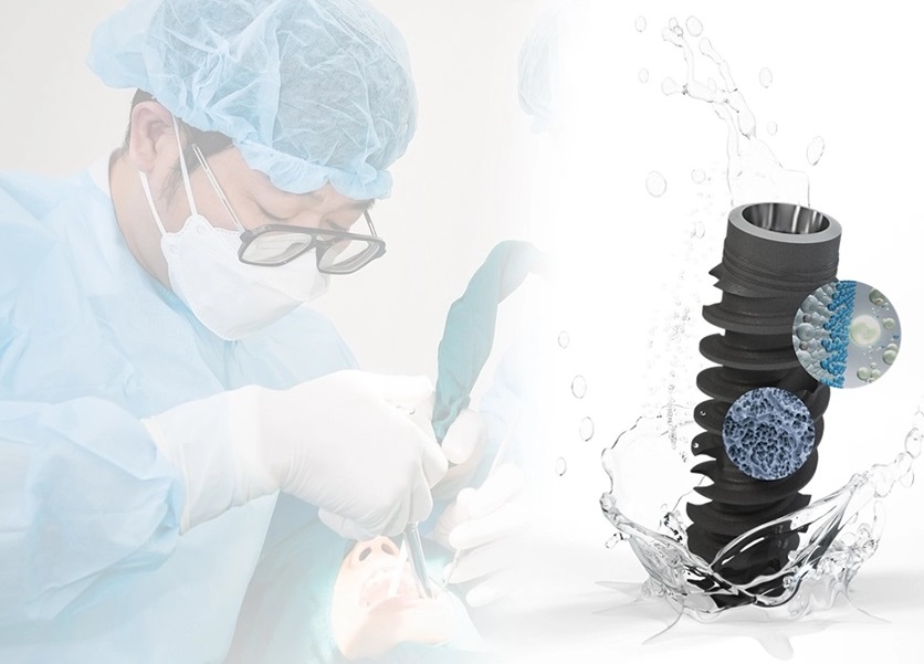 Nha khoa thẩm mỹ Jet Dentist: Cấy ghép Implant Straumann Active