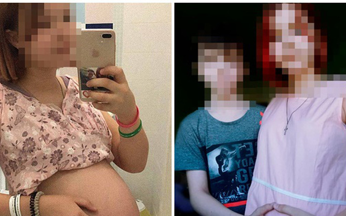 Bé gái 13 tuổi mang thai từng gây rúng động nước Nga đã ''vượt cạn'' sau ca sinh khó và tuyên bố bạn trai 10 tuổi sẽ là cha đứa trẻ