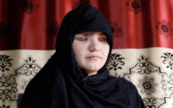 Ký ức kinh hoàng của người phụ nữ mang thai bị Taliban khoét mắt