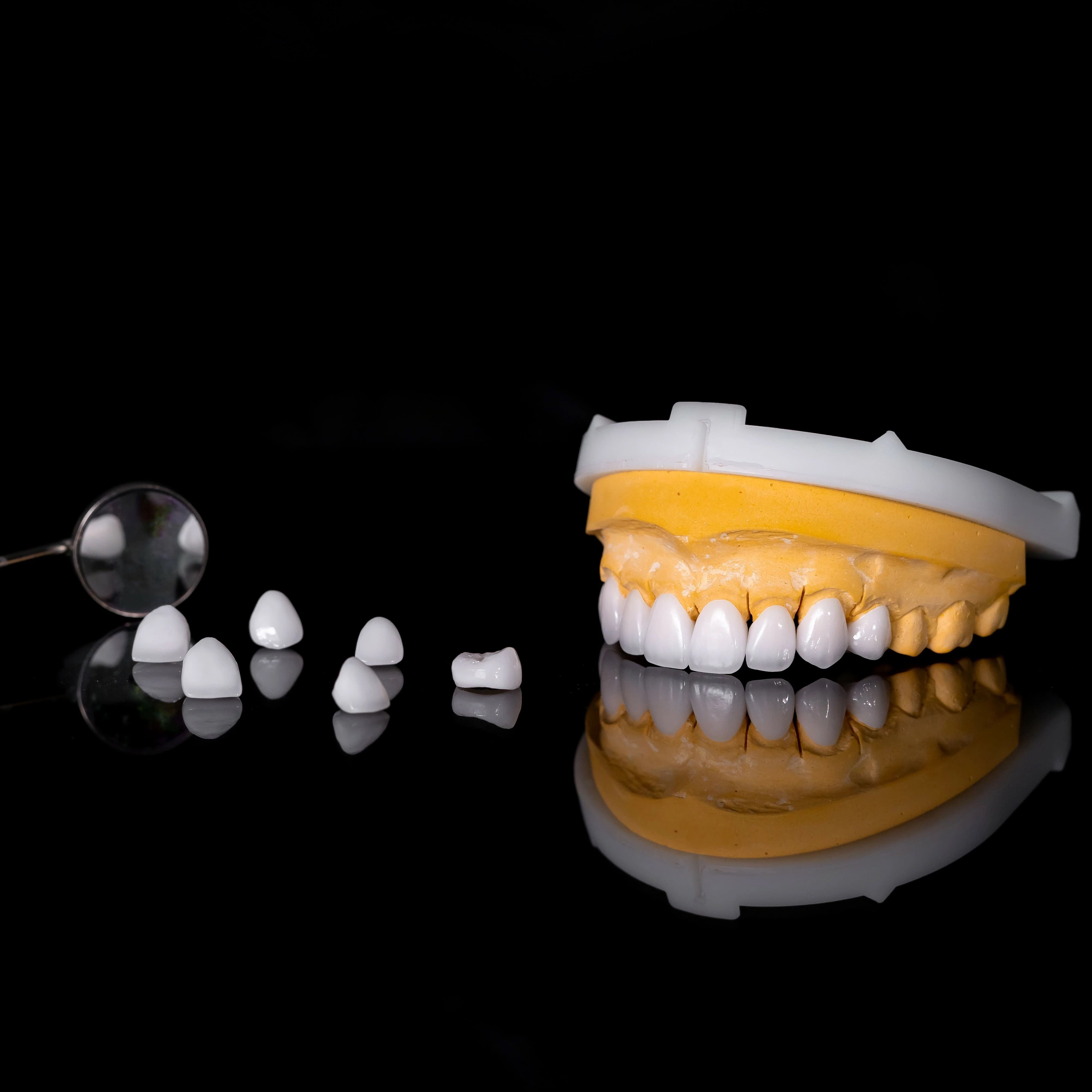 Nha khoa thẩm mỹ Jet Dentist: Răng sứ Orodent Bleach