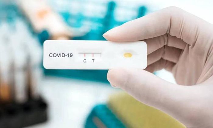 Bộ Y tế đề nghị sớm xem xét đưa kit test xét nghiệm COVID-19 vào diện bình ổn giá