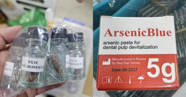 An toàn trong điều trị nha khoa: Chuẩn mực chuyên môn và trách nhiệm với sức khỏe cộng đồng