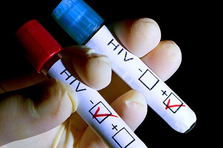 Nga báo động tình trạng nhiễm HIV tăng